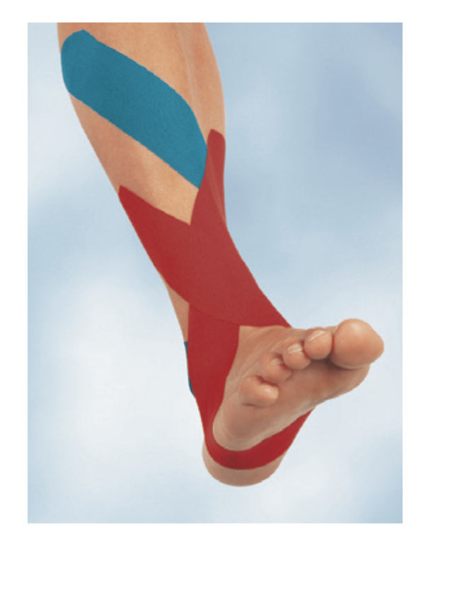 BSN Medical Leukotape K - Kinesio Therapeutic Adhesive Tape